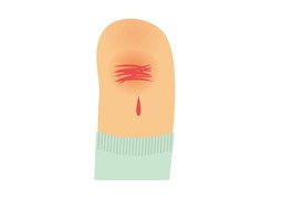创伤のイラスト